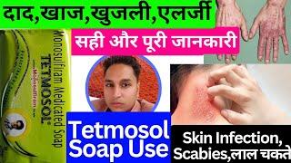 tetmosol soap  tetmosol soap benefits  tetmosol  टेटमोसोल साबुन  tetmosol powder  tetmosol use
