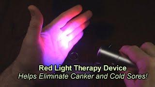 Okyna Red Light Therapy Device for Canker and Cold Sores Infrared Pain Relief Faster Healing REVIEW