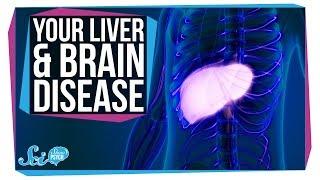 How Liver Problems Can Lead to Brain Disease