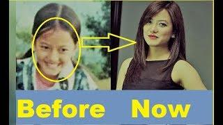 OMG 10 Shocking Transformations Of Nepali Celebrities