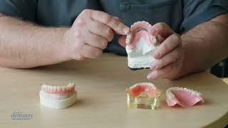 Dental Implants Brisbane - Teeth Replacement Options - Dental Implants vs Dentures vs All-On-X