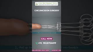 ZSR Circumcision Surgery in Delhi A Step-by-Step Animated Guide  Circumcision Surgery Cost #shorts