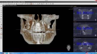 EZ3D2009 просмотр КТ - инструкция пользователя