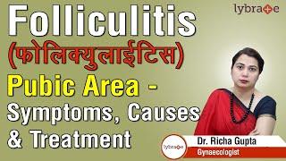 Folliculitis फोलिक्युलाईटिस Pubic Area - Symptoms Causes & Treatment - Dr. Richa Gupta  Lybrate