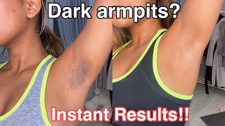 How To Get Rid Of Dark Armpits INSTANTLY 100% works