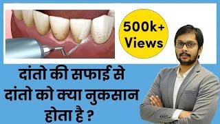 क्या दांतों की सफाई दांतों को नुकसान पहुंचाती है?  Does CleaningSCALING damage teeth? by Dr Ankit