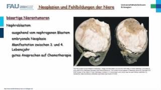 Pathologie ─ Nierentumoren