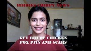 GET RID OF CHICKEN-POX PITS AND SCARS