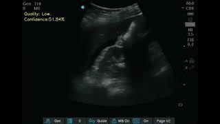 Real-Time Artificial Intelligence–Guided Ultrasonography With Quality and Result Feedback