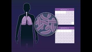 Shorter Course for Tuberculosis Treatment  NEJM