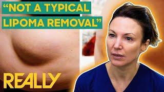 Dr. Emma Has To Stop A Surgery That Is Too Painful For A Patient  The Bad Skin Clinic