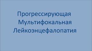 Прогрессирующая мультифокальная лейкоэнцефалопатия