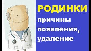 Родинки на теле и лице причины появления удаление