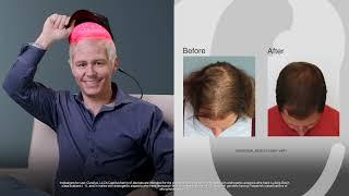 Hair loss no More real men real results with Capillus.