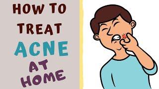 HOW TO TREAT ACNE AT HOME. Acne- All you need to know.