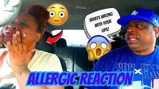 EPIC JUMBO LIPS OUT IN PUBLIC PRANK ON FIANCE  *HILARIOUS REACTION*