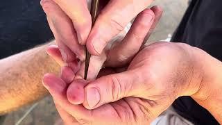 Deep hand reflexology massage using chopsticks.