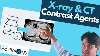 Contrast Agents in X-ray and CT Scans What You Need to Know