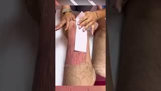 Leg Wax - Removing hair From Leg