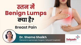 स्तन में benign lumps क्या हैं?  Breast pain  Dr. Shama Shaikh  Sahyadri Hospital