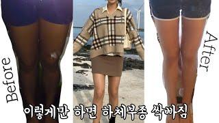 하체부종러들 커몬커몬‍️그거 살 아니고 붓기임.암튼 붓기임•하체비만 다이어트• 다리 붓기빼는 방법• 다리 가늘어지는법