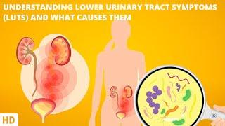 Understanding Lower Urinary Tract Symptoms