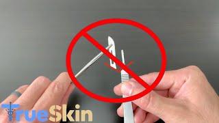 How to Insert and Remove a Scalpel Blade