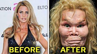 11 Celebrities Who Regret Their Plastic Surgery