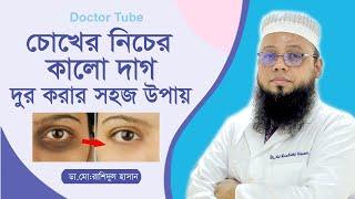 চোখের নিচের কালো দাগ দূর করার উপায়  Bangla Tips Remove dark spots  Choker Kalo Dag Dur Kora upay