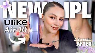 Testing ULIKE Air 10 IPL Hair Removal at Home NO MORE RAZOR BUMBS?