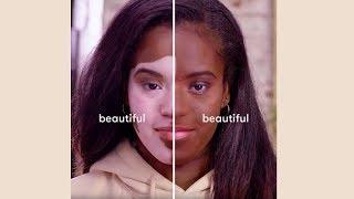 Dermablend Reflections – Foundation for Vitiligo