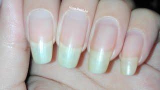How to Grow your Nails Fast in One Week Using Garlic and Olive Oil  Rose Pearl