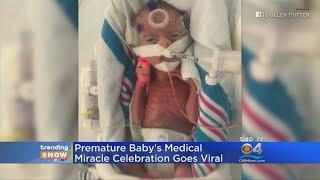 Trending Premature Baby Celebrates