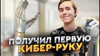 Новая серебристая киби-рука для Богдана из Беларуси