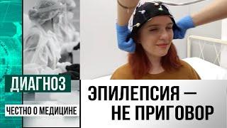 Эпилепсия причины диагностика лечение. О работе Центра эпилептологии в Казахстане  Диагноз