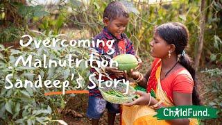 Overcoming Malnutrition Sandeeps Story