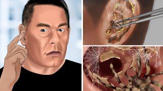 ASMR Remove spiders from ears and treat spider bites for John Cena  WOW Brain Satisfying Video