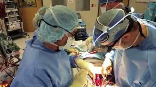 Life in the OR Open heart surgery