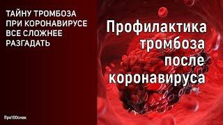 Профилактика тромбоза после коронавируса. Как избежать тромбоза