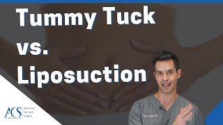 Liposuction and Tummy Tuck Surgery Differences Cost Recovery & Results