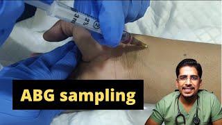 ABG sampling- How & when to do it 
