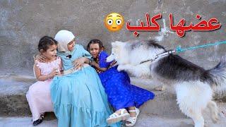 طفله يعضها كلب وتنجلب تكوم تعض الناس