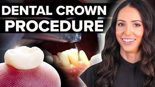 Same Day Dental Crown Procedure Step by Step