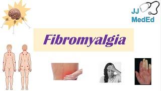 Fibromyalgia  Symptoms Associated Conditions Diagnosis Treatment