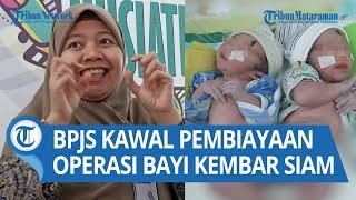 BPJS Kesehatan Siap Mengawal Pembiayaan Operasi Pemisahan Bayi Kembar Siam Tulungagung
