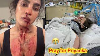 Sad News Priyanka Chopra Severely Injured During Shoot