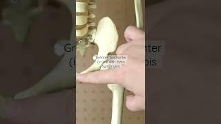 Intramuscular Injection - Ventrogluteal Muscle Skeleton Edition