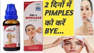 Wipeclear Acne Lotion Homoeopathic Best Acne Lotion