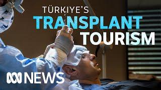 Türkiye’s thriving hair transplant industry  ABC News