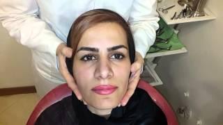 جراحی بینی بابت مشاوره-دکتر راستا09337174804